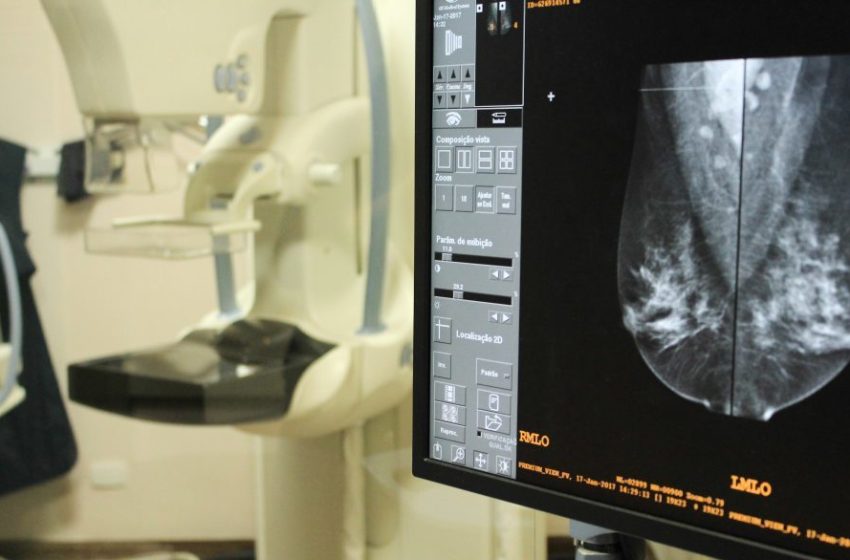  Mutirão de mamografias realiza 60 exames em único dia
